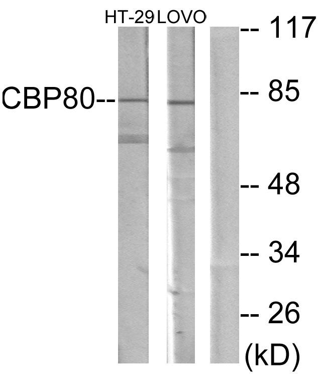 NCBP1 / CBP80 Antibody - Western blot analysis of extracts from HT-29 cells and LOVO cells, using NCBP1 antibody.