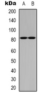 NCBP1 / CBP80 Antibody - Western blot analysis of CBP80 expression in HeLa (A); NIH3T3 (B) whole cell lysates.