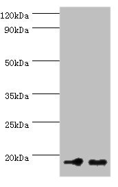 NCBP2 / CBP20 Antibody - Western blot All lanes: NCBP2 antibody at 5µg/ml Lane 1: Hela whole cell lysate Lane 2: NIH/3T3 whole cell lysate Secondary Goat polyclonal to rabbit IgG at 1/10000 dilution Predicted band size: 19, 16, 12 kDa Observed band size: 19 kDa