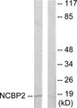 NCBP2 / CBP20 Antibody - Western blot analysis of lysates from COLO205 cells, using NCBP2 Antibody. The lane on the right is blocked with the synthesized peptide.
