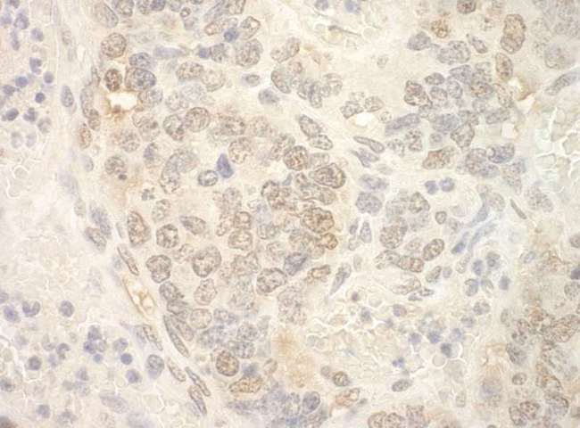 NCBP2 / CBP20 Antibody - Detection of Mouse NCBP2 by Immunohistochemistry. Sample: FFPE section of mouse teratoma. Antibody: Affinity purified rabbit anti-NCBP2 used at a dilution of 1:100.