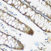 NCBP2 / CBP20 Antibody - Immunohistochemistry of paraffin-embedded human colon tissue.