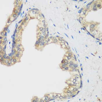 NCBP2 / CBP20 Antibody - Immunohistochemistry of paraffin-embedded human prostate.