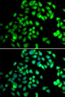 NCBP2 / CBP20 Antibody - Immunofluorescence analysis of MCF7 cells.