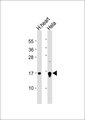 NCBP2 / CBP20 Antibody - All lanes: Anti-CBP20 Antibody at 1:1000 dilution. Lane 1: human heart lysate. Lane 2: HeLa whole cell lysate Lysates/proteins at 20 ug per lane. Secondary Goat Anti-Rabbit IgG, (H+L), Peroxidase conjugated at 1:10000 dilution. Predicted band size: 18 kDa. Blocking/Dilution buffer: 5% NFDM/TBST.
