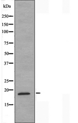 NCBP2 / CBP20 Antibody - Western blot analysis of extracts of COLO205 cells using NCBP2 antibody.