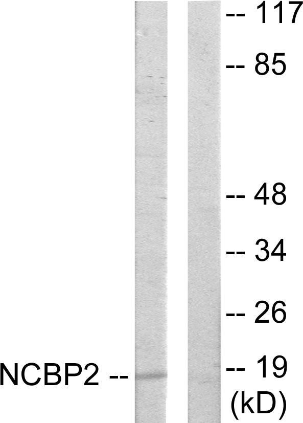 NCBP2 / CBP20 Antibody - Western blot analysis of extracts from COLO205 cells, using NCBP2 antibody.