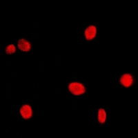 NCBP2 / CBP20 Antibody - Immunofluorescent analysis of CBP20 staining in HeLa cells. Formalin-fixed cells were permeabilized with 0.1% Triton X-100 in TBS for 5-10 minutes and blocked with 3% BSA-PBS for 30 minutes at room temperature. Cells were probed with the primary antibody in 3% BSA-PBS and incubated overnight at 4 deg C in a humidified chamber. Cells were washed with PBST and incubated with a DyLight 594-conjugated secondary antibody (red) in PBS at room temperature in the dark. DAPI was used to stain the cell nuclei (blue).