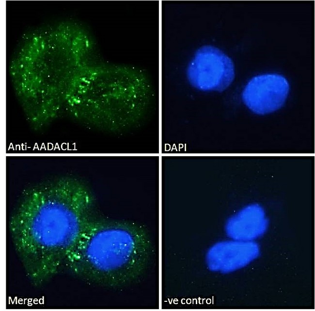 NCEH1 / AADACL1 Antibody - Goat Anti-AADACL1 Antibody Immunofluorescence analysis of paraformaldehyde fixed A431 cells, permeabilized with 0.15% Triton. Primary incubation 1hr (10ug/ml) followed by Alexa Fluor 488 secondary antibody (2ug/ml), showing Endoplasmic reticulum staining. The nuclear stain is DAPI (blue). Negative control: Unimmunized goat IgG (10ug/ml) followed by Alexa Fluor 488 secondary antibody (2ug/ml).