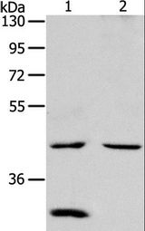 NCEH1 / AADACL1 Antibody - Western blot analysis of Mouse kidney and heart tissue, using NCEH1 Polyclonal Antibody at dilution of 1:1300.
