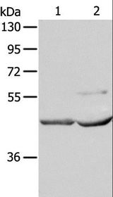 NCEH1 / AADACL1 Antibody - Western blot analysis of Mouse kidney and heart tissue, using NCEH1 Polyclonal Antibody at dilution of 1:1350.