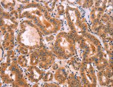 NCEH1 / AADACL1 Antibody - Immunohistochemistry of paraffin-embedded Human brain using NCEH1 Polyclonal Antibody at dilution of 1:80.