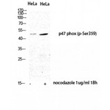 NCF1 / p47phox / p47 phox Antibody - Western blot of Phospho-p47-phox (S359) antibody