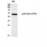 NCF1 / p47phox / p47 phox Antibody - Western blot of Phospho-p47-phox (S370) antibody