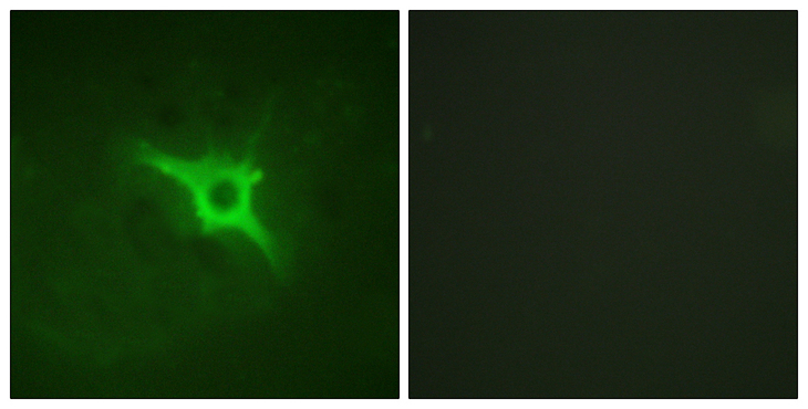 NCF1 / p47phox / p47 phox Antibody - Immunofluorescence analysis of NIH/3T3 cells, using p47 phox Antibody. The picture on the right is blocked with the synthesized peptide.