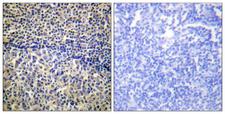 NCF1 / p47phox / p47 phox Antibody - Immunohistochemistry analysis of paraffin-embedded human tonsil tissue, using p47 phox Antibody. The picture on the right is blocked with the synthesized peptide.