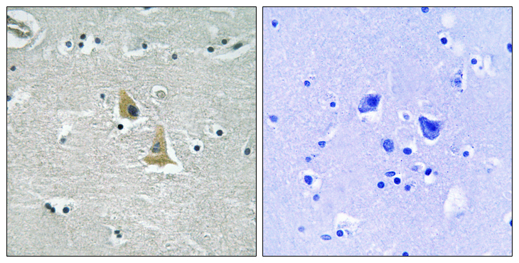 NCF1 / p47phox / p47 phox Antibody - Immunohistochemistry analysis of paraffin-embedded human brain tissue, using p47 phox Antibody. The picture on the right is blocked with the synthesized peptide.