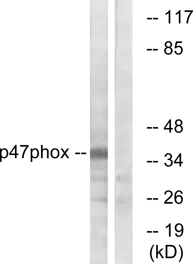 NCF1 / p47phox / p47 phox Antibody - Western blot analysis of lysates from HeLa cells, treated with TSA 400ng/ml 24h, using p47 phox Antibody. The lane on the right is blocked with the synthesized peptide.