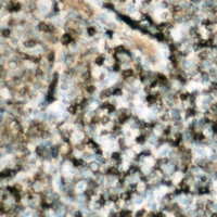 NCF1 / p47phox / p47 phox Antibody - Immunohistochemical analysis of p47 phox (pS359) staining in human lymph node formalin fixed paraffin embedded tissue section. The section was pre-treated using heat mediated antigen retrieval with sodium citrate buffer (pH 6.0). The section was then incubated with the antibody at room temperature and detected using an HRP conjugated compact polymer system. DAB was used as the chromogen. The section was then counterstained with hematoxylin and mounted with DPX.