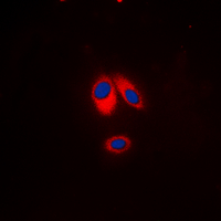 NCF1 / p47phox / p47 phox Antibody - Immunofluorescent analysis of p47 phox (pS359) staining in HeLa cells. Formalin-fixed cells were permeabilized with 0.1% Triton X-100 in TBS for 5-10 minutes and blocked with 3% BSA-PBS for 30 minutes at room temperature. Cells were probed with the primary antibody in 3% BSA-PBS and incubated overnight at 4 deg C in a humidified chamber. Cells were washed with PBST and incubated with a DyLight 594-conjugated secondary antibody (red) in PBS at room temperature in the dark. DAPI was used to stain the cell nuclei (blue).