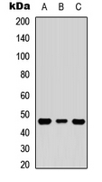 NCF1 / p47phox / p47 phox Antibody - Western blot analysis of p47 phox expression in Raji (A); Ramos (B); Raw264.7 (C) whole cell lysates.