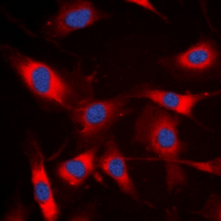 NCF1 / p47phox / p47 phox Antibody - Immunofluorescent analysis of p47 phox staining in Raji cells. Formalin-fixed cells were permeabilized with 0.1% Triton X-100 in TBS for 5-10 minutes and blocked with 3% BSA-PBS for 30 minutes at room temperature. Cells were probed with the primary antibody in 3% BSA-PBS and incubated overnight at 4 deg C in a humidified chamber. Cells were washed with PBST and incubated with a DyLight 594-conjugated secondary antibody (red) in PBS at room temperature in the dark. DAPI was used to stain the cell nuclei (blue).