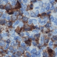 NCF1 / p47phox / p47 phox Antibody - Immunohistochemical analysis of p47 phox staining in human lymph node formalin fixed paraffin embedded tissue section. The section was pre-treated using heat mediated antigen retrieval with sodium citrate buffer (pH 6.0). The section was then incubated with the antibody at room temperature and detected using an HRP polymer system. DAB was used as the chromogen. The section was then counterstained with hematoxylin and mounted with DPX.
