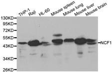 NCF1 / p47phox / p47 phox Antibody - Western blot analysis of extracts of various cell lines, using NCF1 antibody at 1:1000 dilution. The secondary antibody used was an HRP Goat Anti-Rabbit IgG (H+L) at 1:10000 dilution. Lysates were loaded 25ug per lane and 3% nonfat dry milk in TBST was used for blocking.