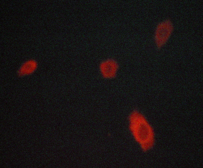 NCF1 / p47phox / p47 phox Antibody - Staining LOVO cells by IF/ICC. The samples were fixed with PFA and permeabilized in 0.1% saponin prior to blocking in 10% serum for 45 min at 37°C. The primary antibody was diluted 1/400 and incubated with the sample for 1 hour at 37°C. A Alexa Fluor® 594 conjugated goat polyclonal to rabbit IgG (H+L), diluted 1/600 was used as secondary antibody.