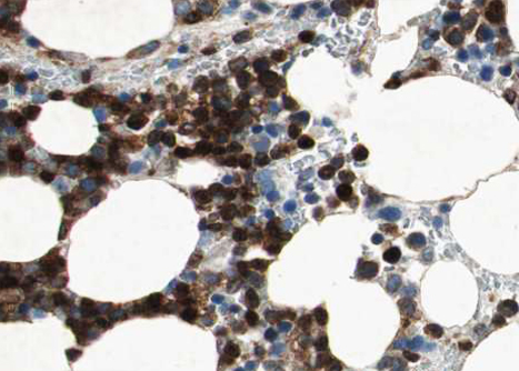 NCF1 / p47phox / p47 phox Antibody - 1:100 staining human Bone marrow tissue by IHC-P. The tissue was formaldehyde fixed and a heat mediated antigen retrieval step in citrate buffer was performed. The tissue was then blocked and incubated with the antibody for 1.5 hours at 22°C. An HRP conjugated goat anti-rabbit antibody was used as the secondary.