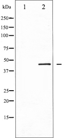 NCF1 / p47phox / p47 phox Antibody - Western blot analysis of p47 phox expression in TSA treated HeLa whole cells lysates. The lane on the left is treated with the antigen-specific peptide.