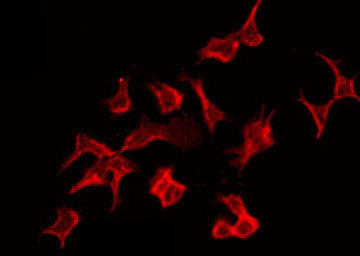 NCF1 / p47phox / p47 phox Antibody - Staining HeLa cells by IF/ICC. The samples were fixed with PFA and permeabilized in 0.1% Triton X-100, then blocked in 10% serum for 45 min at 25°C. The primary antibody was diluted at 1:200 and incubated with the sample for 1 hour at 37°C. An Alexa Fluor 594 conjugated goat anti-rabbit IgG (H+L) Ab, diluted at 1/600, was used as the secondary antibody.