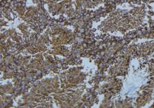 NCF1 / p47phox / p47 phox Antibody - 1:100 staining mouse testis tissue by IHC-P. The sample was formaldehyde fixed and a heat mediated antigen retrieval step in citrate buffer was performed. The sample was then blocked and incubated with the antibody for 1.5 hours at 22°C. An HRP conjugated goat anti-rabbit antibody was used as the secondary.
