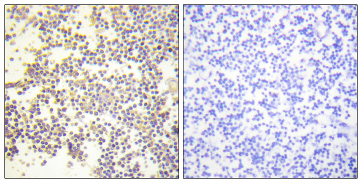 NCF1 / p47phox / p47 phox Antibody - Immunohistochemistry analysis of paraffin-embedded human tonsil, using Neutrophil Cytosol Factor 1 (Phospho-Ser328) Antibody. The picture on the right is blocked with the phospho peptide.