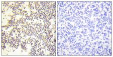 NCF1 / p47phox / p47 phox Antibody - Immunohistochemistry analysis of paraffin-embedded human tonsil, using Neutrophil Cytosol Factor 1 (Phospho-Ser328) Antibody. The picture on the right is blocked with the phospho peptide.