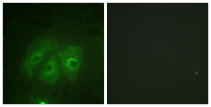 NCF1 / p47phox / p47 phox Antibody - Immunofluorescence analysis of HeLa cells, using p47 phox (Phospho-Ser359) Antibody. The picture on the right is blocked with the phospho peptide.