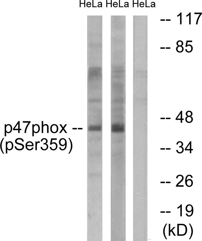 NCF1 / p47phox / p47 phox Antibody - Western blot analysis of lysates from HeLa cells treated with nocodazole 1ug/ml 18h, using p47 phox (Phospho-Ser359) Antibody. The lane on the right is blocked with the phospho peptide.