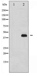 NCF1 / p47phox / p47 phox Antibody - Western blot of p47 phox phosphorylation expression in nocodazole treated HeLa whole cell lysates,The lane on the left is treated with the antigen-specific peptide.