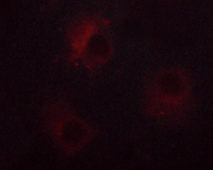 NCF1 / p47phox / p47 phox Antibody - Staining RL cells by IF/ICC. The samples were fixed with PFA and permeabilized in 0.1% saponin prior to blocking in 10% serum for 45 min at 37°C. The primary antibody was diluted 1/400 and incubated with the sample for 1 hour at 37°C. A Alexa Fluor® 594 conjugated goat polyclonal to rabbit IgG (H+L), diluted 1/600 was used as secondary antibody.