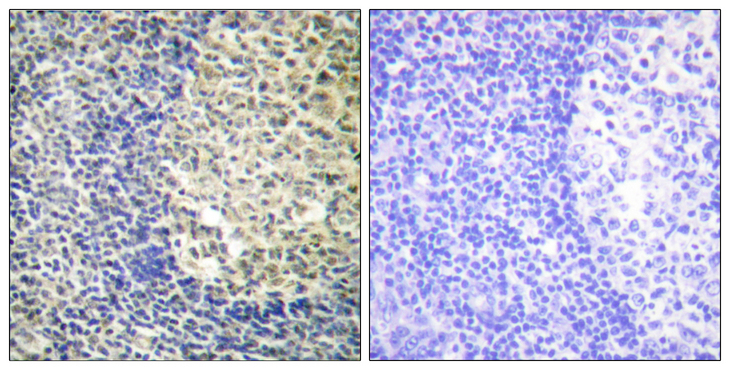 NCF1 / p47phox / p47 phox Antibody - Immunohistochemistry analysis of paraffin-embedded human tonsil, using p47 phox (Phospho-Ser370) Antibody. The picture on the right is blocked with the phospho peptide.