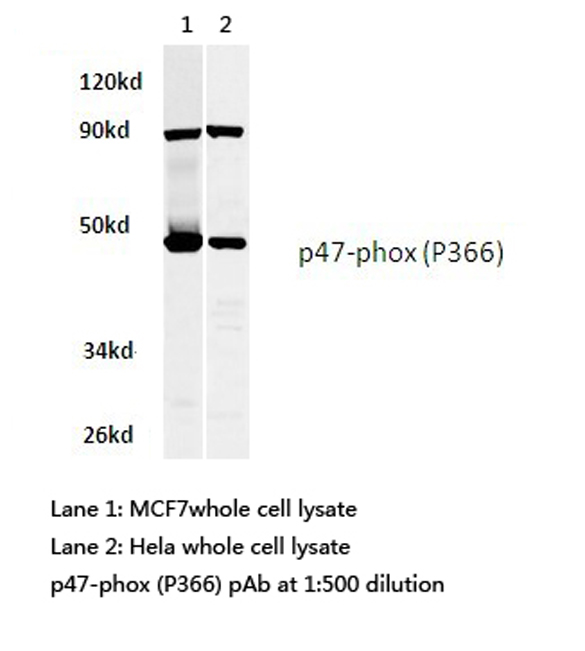 NCF1 / p47phox / p47 phox Antibody - Western blot of p47-phox (P366) pAb in extracts from MCF7 and HeLa cells.