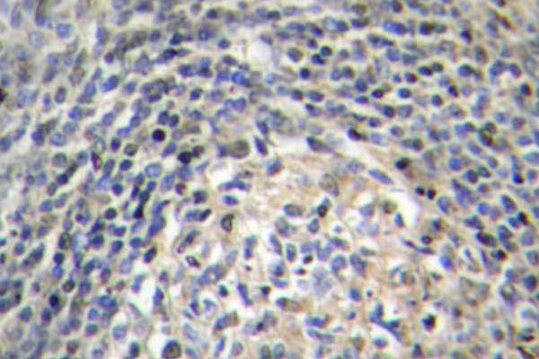 NCF1 / p47phox / p47 phox Antibody - IHC of p47-phox (P366) pAb in paraffin-embedded human testis tissue.