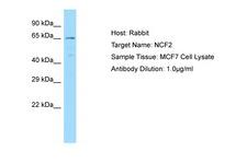 NCF2 / NOXA2 / p67phox Antibody -  This image was taken for the unconjugated form of this product. Other forms have not been tested.