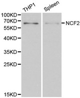 NCF2 / NOXA2 / p67phox Antibody - Western blot of NCF2 pAb in extracts from THP1 cells and mouse spleen tissue.
