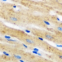 NCF2 / NOXA2 / p67phox Antibody - Immunohistochemical analysis of p67 phox staining in mouse heart formalin fixed paraffin embedded tissue section. The section was pre-treated using heat mediated antigen retrieval with sodium citrate buffer (pH 6.0). The section was then incubated with the antibody at room temperature and detected using an HRP conjugated compact polymer system. DAB was used as the chromogen. The section was then counterstained with hematoxylin and mounted with DPX.