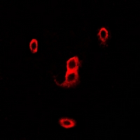NCF2 / NOXA2 / p67phox Antibody - Immunofluorescent analysis of p67 phox staining in HeLa cells. Formalin-fixed cells were permeabilized with 0.1% Triton X-100 in TBS for 5-10 minutes and blocked with 3% BSA-PBS for 30 minutes at room temperature. Cells were probed with the primary antibody in 3% BSA-PBS and incubated overnight at 4 deg C in a humidified chamber. Cells were washed with PBST and incubated with a DyLight 594-conjugated secondary antibody (red) in PBS at room temperature in the dark.