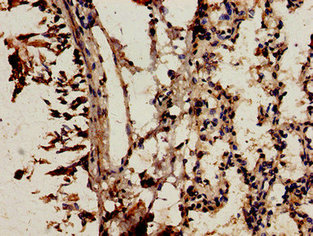 NCF2 / NOXA2 / p67phox Antibody - Immunocytochemistry analysis of human lung tissue at a dilution of 1:100