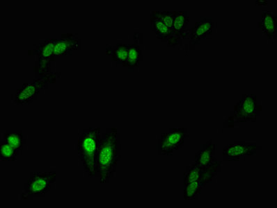 NCF2 / NOXA2 / p67phox Antibody - Immunofluorescent analysis of Hela cells at a dilution of 1:100 and Alexa Fluor 488-congugated AffiniPure Goat Anti-Rabbit IgG(H+L)