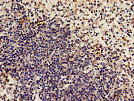 NCF2 / NOXA2 / p67phox Antibody - Immunohistochemistry analysis of human spleen tissue at a dilution of 1:100