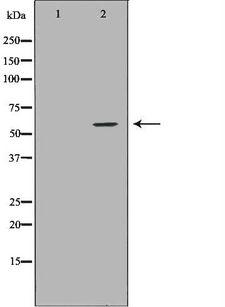 NCF2 / NOXA2 / p67phox Antibody - Western blot analysis of THP1 using NCF2 antibody. The lane on the left is treated with the antigen-specific peptide.